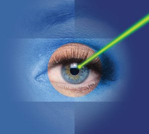 laser assisted cataract surgery